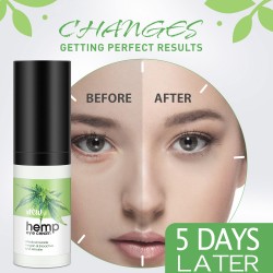 EUHEMP Eye Cream Moisturizer, Anti-aging Eye Gel for Wrinkles, Best Day & Night Eye Treatment EUHEMP Eye Cream Moisturizer, Anti-aging Eye Gel for Wrinkles, Best Day & Night Eye Treatment